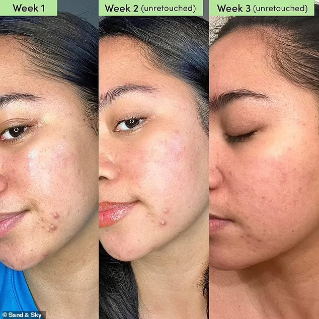 Radiant Renewal Polish Pads™