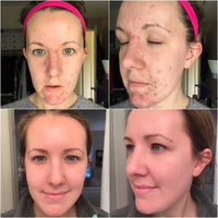Radiant Renewal Polish Pads™